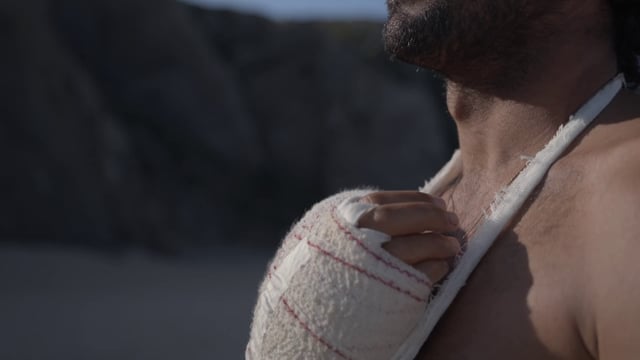 A man with his broken hand in a gypsum bandage
